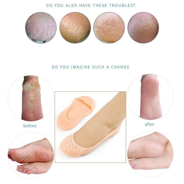 Anti Crack silicone Gel Foot Protector Moisturizing Socks - Image 3